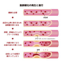 ｜高気密高断熱｜パッシブデザイン｜上越・糸魚川・妙高の工務店｜新築・リフォーム｜自然素材の注文住宅｜キノイエ｜カネタ建設｜