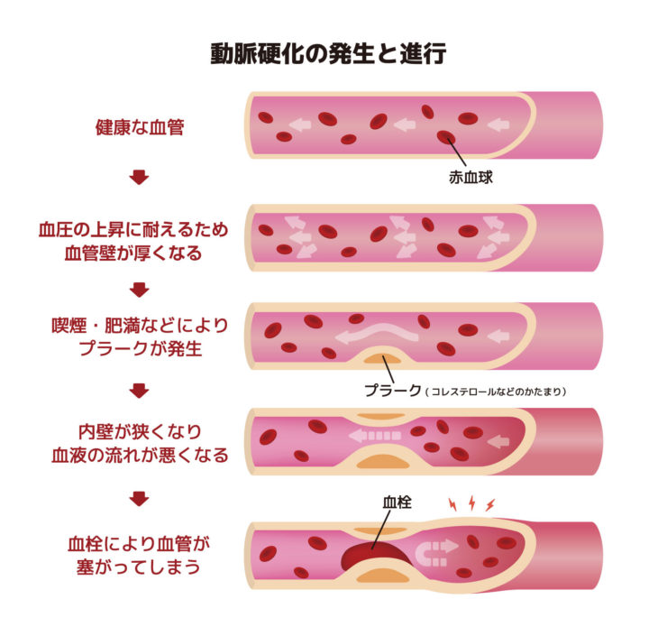 ｜高気密高断熱｜パッシブデザイン｜上越・糸魚川・妙高の工務店｜新築・リフォーム｜自然素材の注文住宅｜キノイエ｜カネタ建設｜